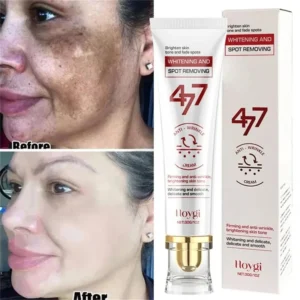 Leistungsstarke, fleckenentfernende Aufhellungscreme, hellt die Haut schnell auf, beseitigt Melaninpigmentierung, Melasma, dunkle Flecken, koreanische Gesichtspflege